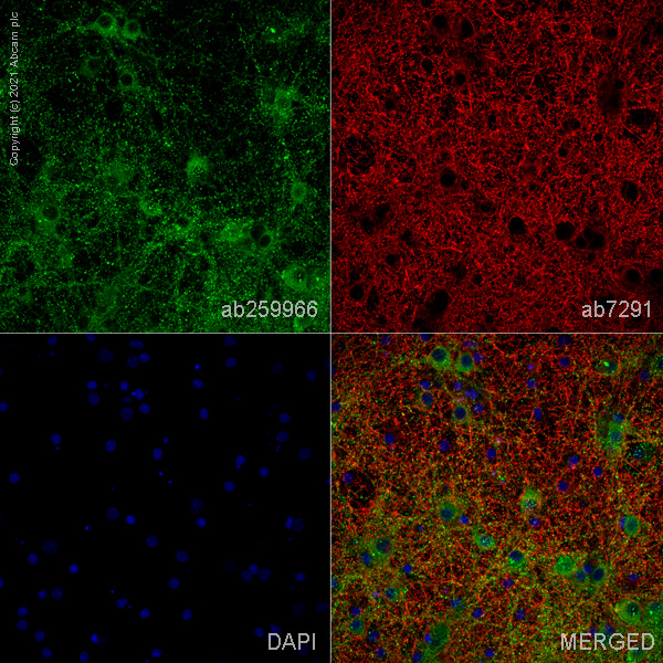 Immunocytochemistry/ Immunofluorescence - Anti-SHANK2 antibody [EPR24142-35] (AB259966), expandable thumbnail