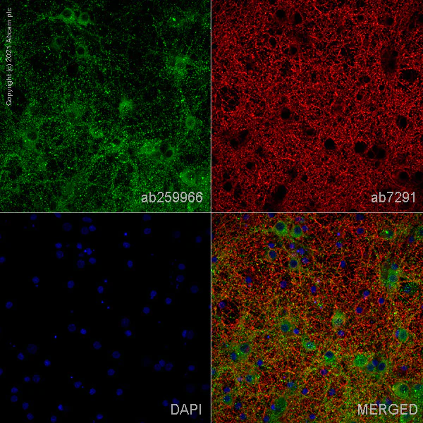 Immunocytochemistry/ Immunofluorescence - Anti-SHANK2 antibody [EPR24142-35] (AB259966)