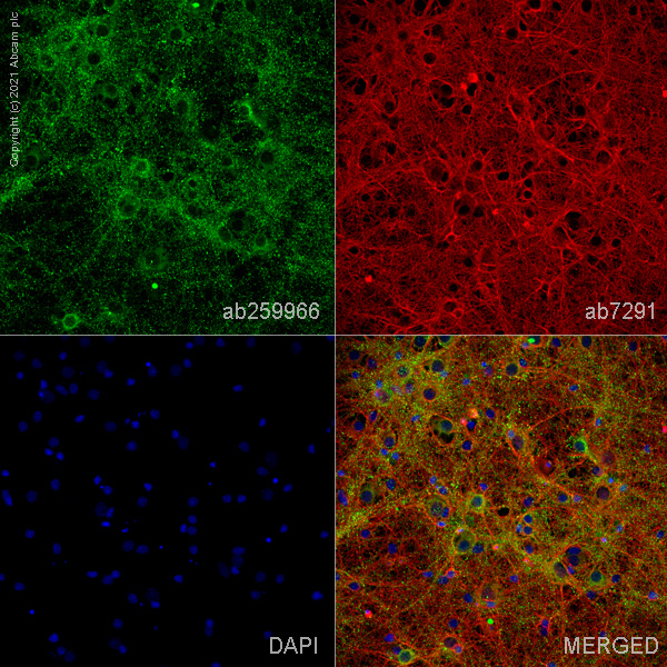 Immunocytochemistry/ Immunofluorescence - Anti-SHANK2 antibody [EPR24142-35] (AB259966), expandable thumbnail