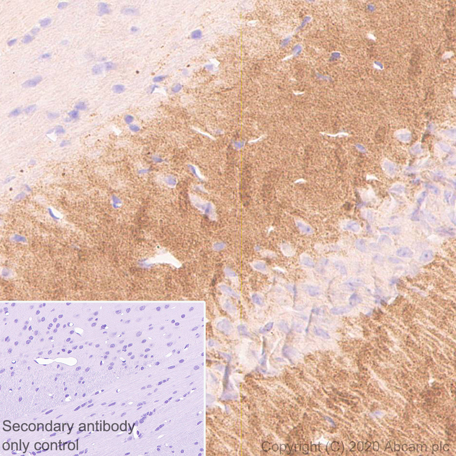 Immunohistochemistry (Formalin/PFA-fixed paraffin-embedded sections) - Anti-SHANK2 antibody [EPR24142-35] (AB259966), expandable thumbnail
