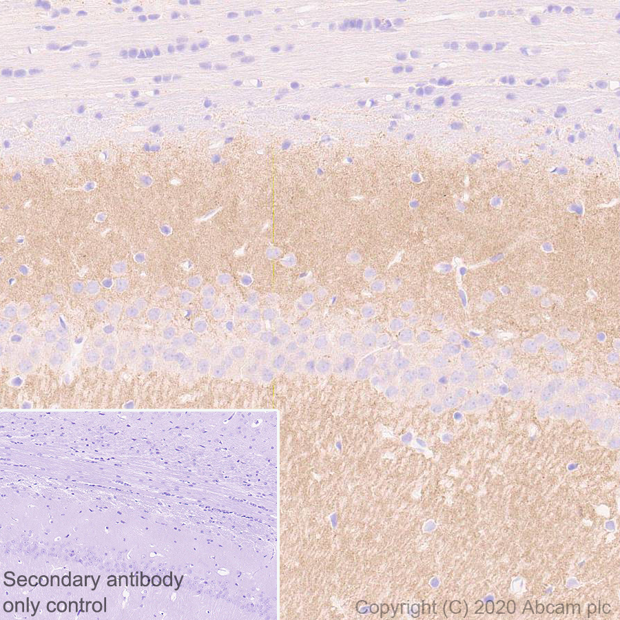 Immunohistochemistry (Formalin/PFA-fixed paraffin-embedded sections) - Anti-SHANK2 antibody [EPR24142-35] (ab259966), expandable thumbnail