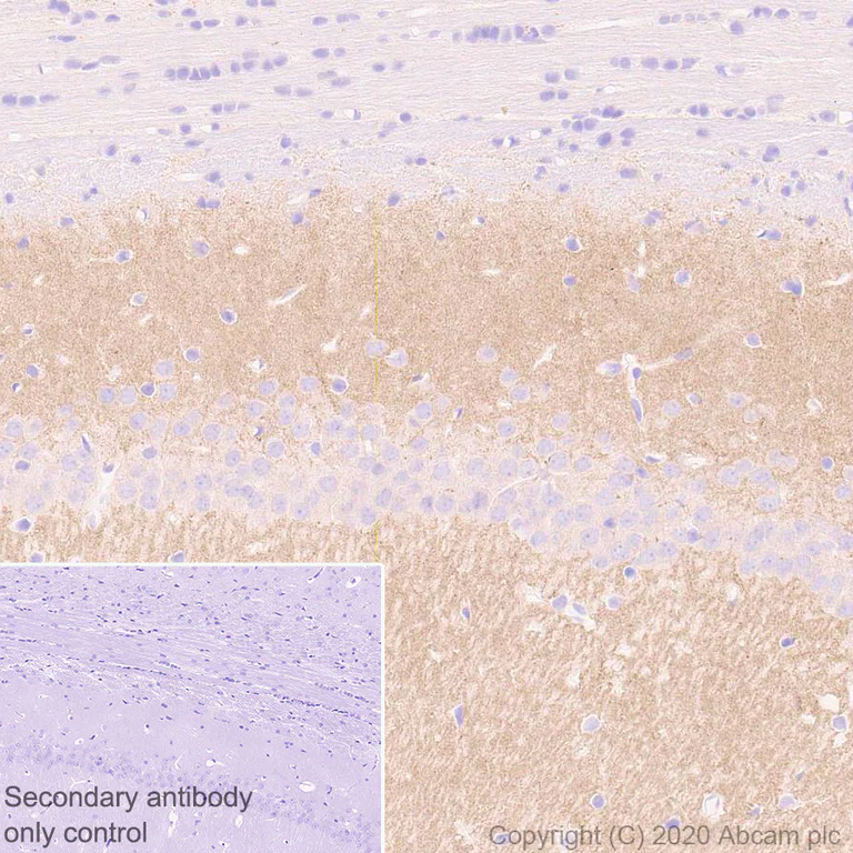 Immunohistochemistry (Formalin/PFA-fixed paraffin-embedded sections) - Anti-SHANK2 antibody [EPR24142-35] (AB259966)