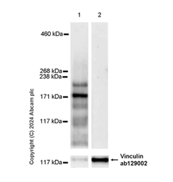 Western blot - Anti-SHANK2 antibody [EPR26549-331] - BSA and Azide free (AB317607)