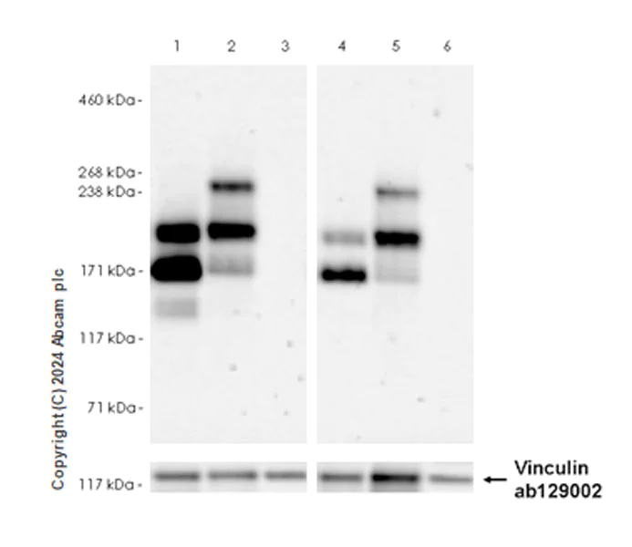 Western blot - Anti-SHANK2 antibody [EPR26549-331] - BSA and Azide free (AB317607)