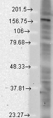 Western blot - Anti-SHANK2 antibody [N23B/49] (AB94575), expandable thumbnail