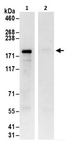Immunoprecipitation - Anti-SHANK3 antibody (AB264347), expandable thumbnail