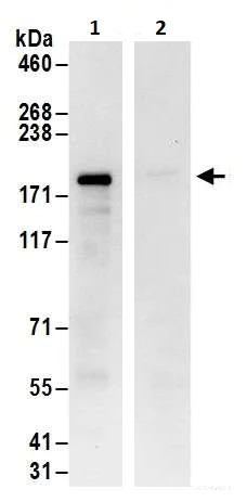 Immunoprecipitation - Anti-SHANK3 antibody (AB264347)