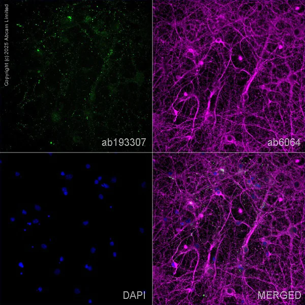 Immunocytochemistry/ Immunofluorescence - Anti-SHANK3 antibody [N69/46] (AB193307)