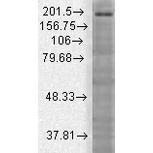 Western blot - Anti-SHANK3 antibody [S69] (AB93607)