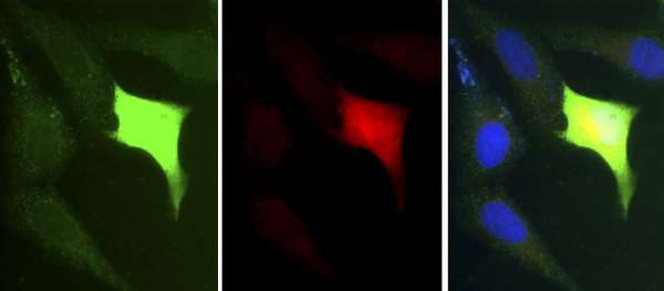 Immunocytochemistry/ Immunofluorescence - Anti-SHARPIN antibody (AB197853), expandable thumbnail