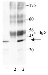 Immunoprecipitation - Anti-SHARPIN antibody (AB197853), expandable thumbnail