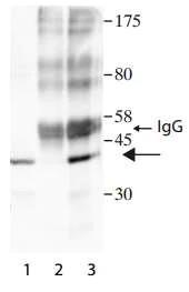 Immunoprecipitation - Anti-SHARPIN antibody (AB197853)
