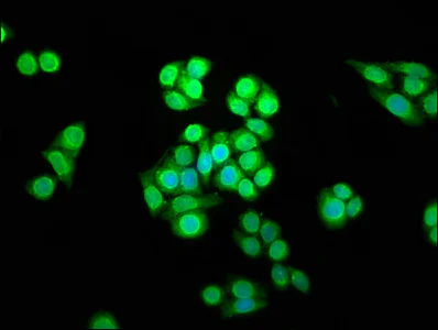 Immunocytochemistry/ Immunofluorescence - Anti-SHARPIN antibody (AB236092)