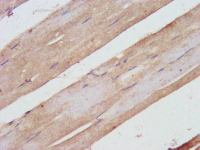 Immunohistochemistry (Formalin/PFA-fixed paraffin-embedded sections) - Anti-SHARPIN antibody (AB236092)