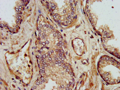 Immunohistochemistry (Formalin/PFA-fixed paraffin-embedded sections) - Anti-SHARPIN antibody (AB236092)