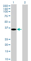 Western blot - Anti-SHARPIN antibody (AB69507)