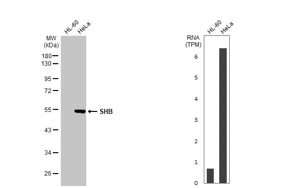 Western blot - Anti-SHB antibody [HL1455] (AB308572)