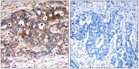 Immunohistochemistry (Formalin/PFA-fixed paraffin-embedded sections) - Anti-SHC antibody (AB131515)