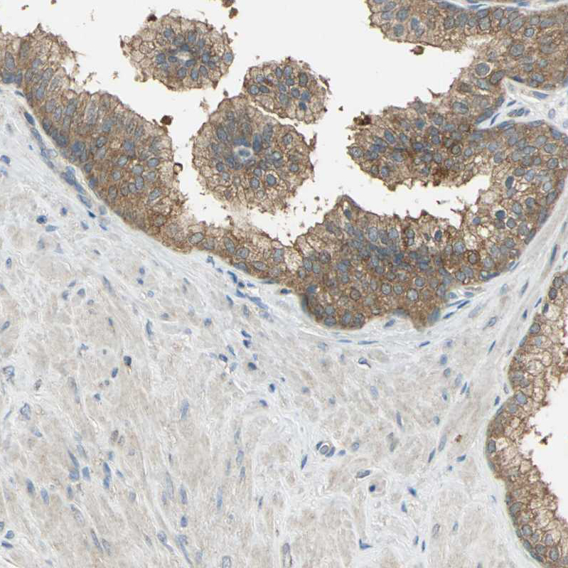 Immunohistochemistry (Formalin/PFA-fixed paraffin-embedded sections) - Anti-SHC2 antibody (AB243385)
