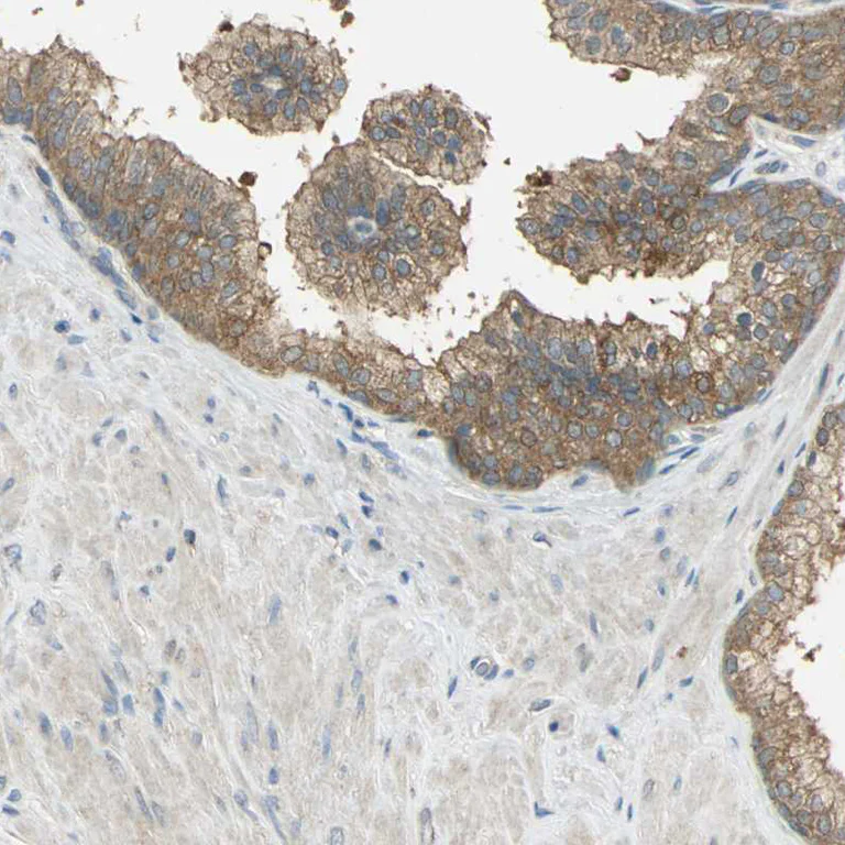 Immunohistochemistry (Formalin/PFA-fixed paraffin-embedded sections) - Anti-SHC2 antibody (AB243385)