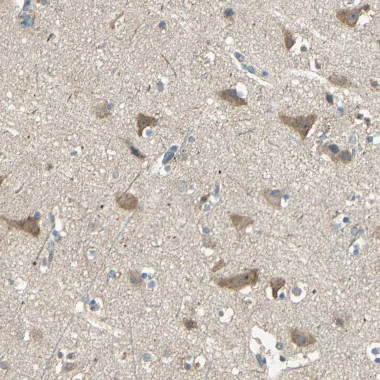 Immunohistochemistry (Formalin/PFA-fixed paraffin-embedded sections) - Anti-SHC2 antibody (AB243385)