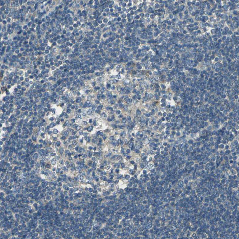 Immunohistochemistry (Formalin/PFA-fixed paraffin-embedded sections) - Anti-SHC2 antibody (AB243385)