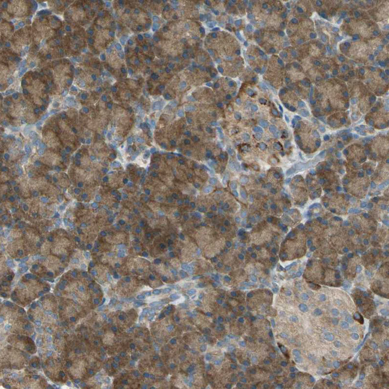 Immunohistochemistry (Formalin/PFA-fixed paraffin-embedded sections) - Anti-SHC2 antibody (AB243385)