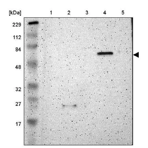 Western blot - Anti-SHC2 antibody (AB243385)