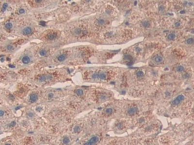 Immunohistochemistry (Formalin/PFA-fixed paraffin-embedded sections) - Anti-SHC3/SHCC antibody (AB233477)