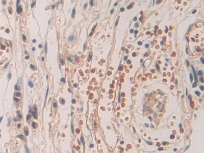 Immunohistochemistry (Formalin/PFA-fixed paraffin-embedded sections) - Anti-SHC3/SHCC antibody (AB233477)