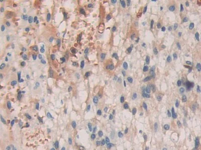 Immunohistochemistry (Formalin/PFA-fixed paraffin-embedded sections) - Anti-SHC3/SHCC antibody (AB233477)