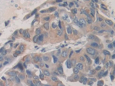 Immunohistochemistry (Formalin/PFA-fixed paraffin-embedded sections) - Anti-SHC3/SHCC antibody (AB233477)