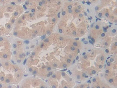 Immunohistochemistry (Formalin/PFA-fixed paraffin-embedded sections) - Anti-SHC3/SHCC antibody (AB233477)