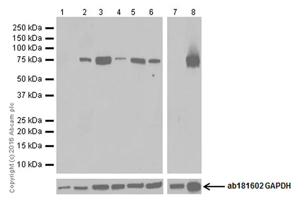 Western blot - Anti-SHCBP1 antibody [EPR18843] (AB184467)