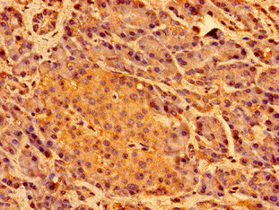 Immunohistochemistry (Formalin/PFA-fixed paraffin-embedded sections) - Anti-SHE antibody (AB236588)