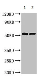 Western blot - Anti-SHE antibody (AB236588)