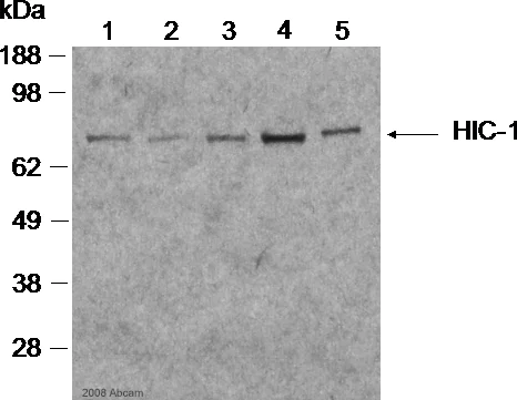 Western blot - Sheep Anti-Mouse IgG H&L (HRP) (AB6808)