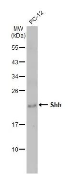 Western blot - Anti-Shh antibody [HL2076] (AB308225), expandable thumbnail