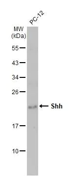 Western blot - Anti-Shh antibody [HL2076] (AB308225)