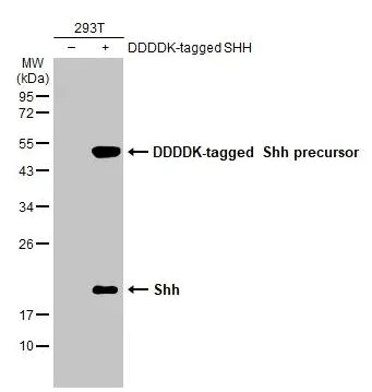 Western blot - Anti-Shh antibody [HL2076] (AB308225)