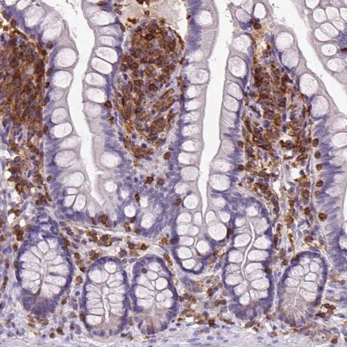 Immunohistochemistry (Formalin/PFA-fixed paraffin-embedded sections) - Anti-SHIP-1 antibody (AB244542)