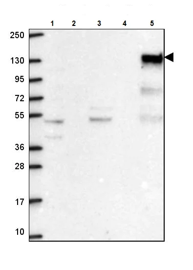 Western blot - Anti-SHIP-1 antibody (AB244542)
