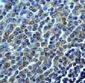 Immunohistochemistry (Formalin/PFA-fixed paraffin-embedded sections) - Anti-SHIP-1 antibody [EP378Y] (AB45142)