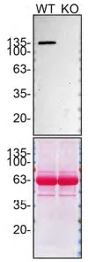 Western blot - Anti-SHIP-1 antibody [EP378Y] (AB45142)