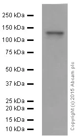 Western blot - Anti-SHIP-1 antibody [EP378Y] (AB45142)