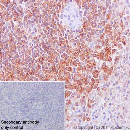 Immunohistochemistry (Formalin/PFA-fixed paraffin-embedded sections) - Anti-SHIP-1 antibody [EP378Y] - BSA and Azide free (AB190551)