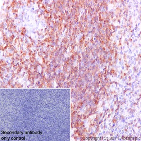 Immunohistochemistry (Formalin/PFA-fixed paraffin-embedded sections) - Anti-SHIP-1 antibody [EP378Y] - BSA and Azide free (AB190551)