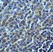 Immunohistochemistry (Formalin/PFA-fixed paraffin-embedded sections) - Anti-SHIP-1 antibody [EP378Y] - BSA and Azide free (ab190551), expandable thumbnail