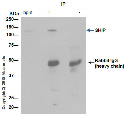 Immunoprecipitation - Anti-SHIP-1 antibody [EP378Y] - BSA and Azide free (AB190551), expandable thumbnail