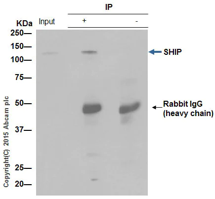 Immunoprecipitation - Anti-SHIP-1 antibody [EP378Y] - BSA and Azide free (AB190551)